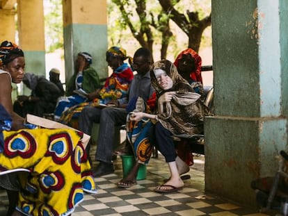 Rabiatou Traor&eacute;, de 15 a&ntilde;os, fotografiada el 26 de junio en el hospital de Bamako. Padece un c&aacute;ncer de piel en la cabeza. 