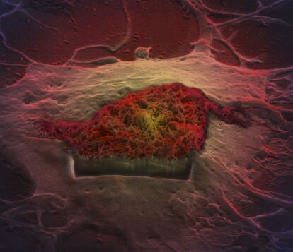 Imagem microscópica que mostra a interação entre um astrócito (em verde) e nanotubos de carbono (em marrom). Catherine Draycott, diretora da Wellcome Images e membro do júri, afirma que a seleção deste ano “não só é linda como também mostra uma variedade incrível de técnicas inovadoras” que permitem obter esse tipo de fotografia científica.