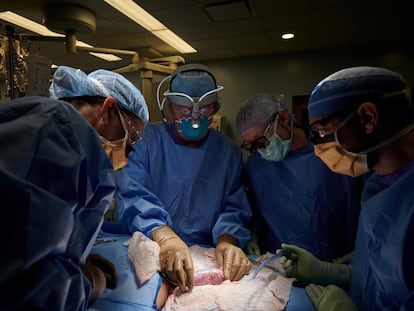 El equipo de Robert Montgomery, en pleno trasplante del riñón de cerdo, el 25 de septiembre.