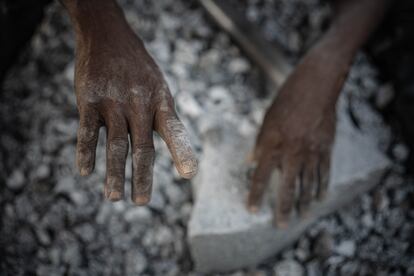 Brigitte muestra sus manos deterioradas por el trabajo. Las piedras de granito se pican con una barra de acero, una tarea que provoca graves lesiones, sobre todo en el caso de los mineros que no cuentan con ningún instrumento de protección para sus trabajadores.