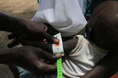 Un sanitario usa una cinta métrica para averiguar si un niño sufre desnutrición aguda.