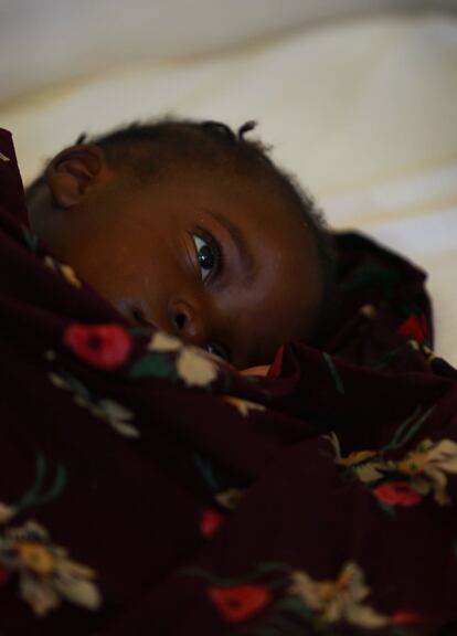 La malaria es una de las principales enfermedades a las que se enfrentan en los hospitales y centros de salud de Mozambique. En Magude, la incidencia es del 9%, mientras que en otros distritos del norte supera el 50%. Esta es la tasa de portadores del plasmodium, el parásito que causa la dolencia, pero no todos ellos desarrollan los síntomas. Este niño sí los manifestaba.