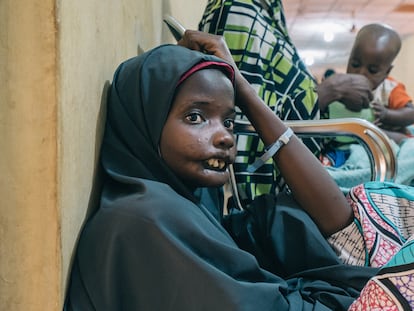 Amina, una paciente de noma de 18 años del estado de Yobe (Nigeria), en una visita al Hospital Sokoto Noma. Ella es una de las protagonistas del documental 'Restoring Dignity', de los cineastas franceses Claire Jeantet y Fabrice Catérini, producido por Inediz en colaboración con Médicos sin Fronteras (MSF).