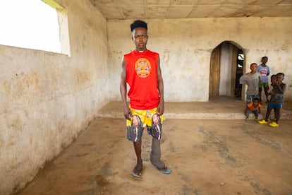 David Sumo is 18 years old and suffers from lymphatic filariasis, a mosquito-borne disease that creates deformities in his limbs.