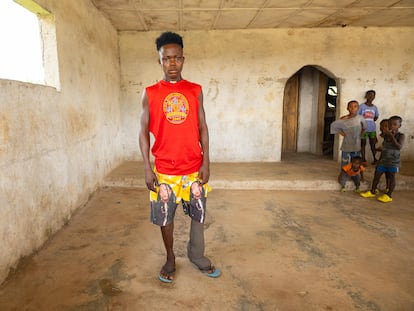 David Sumo tiene 18 años y padece filariasis linfática, una enfermedad transmitida por mosquitos que crea deformidades en las extremidades.
