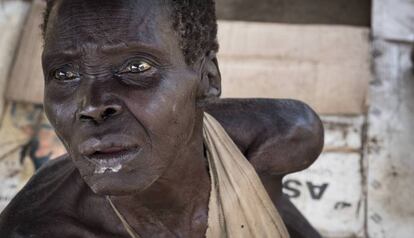 Como tantos sudaneses del sur, esta anciana sufre de inanición.