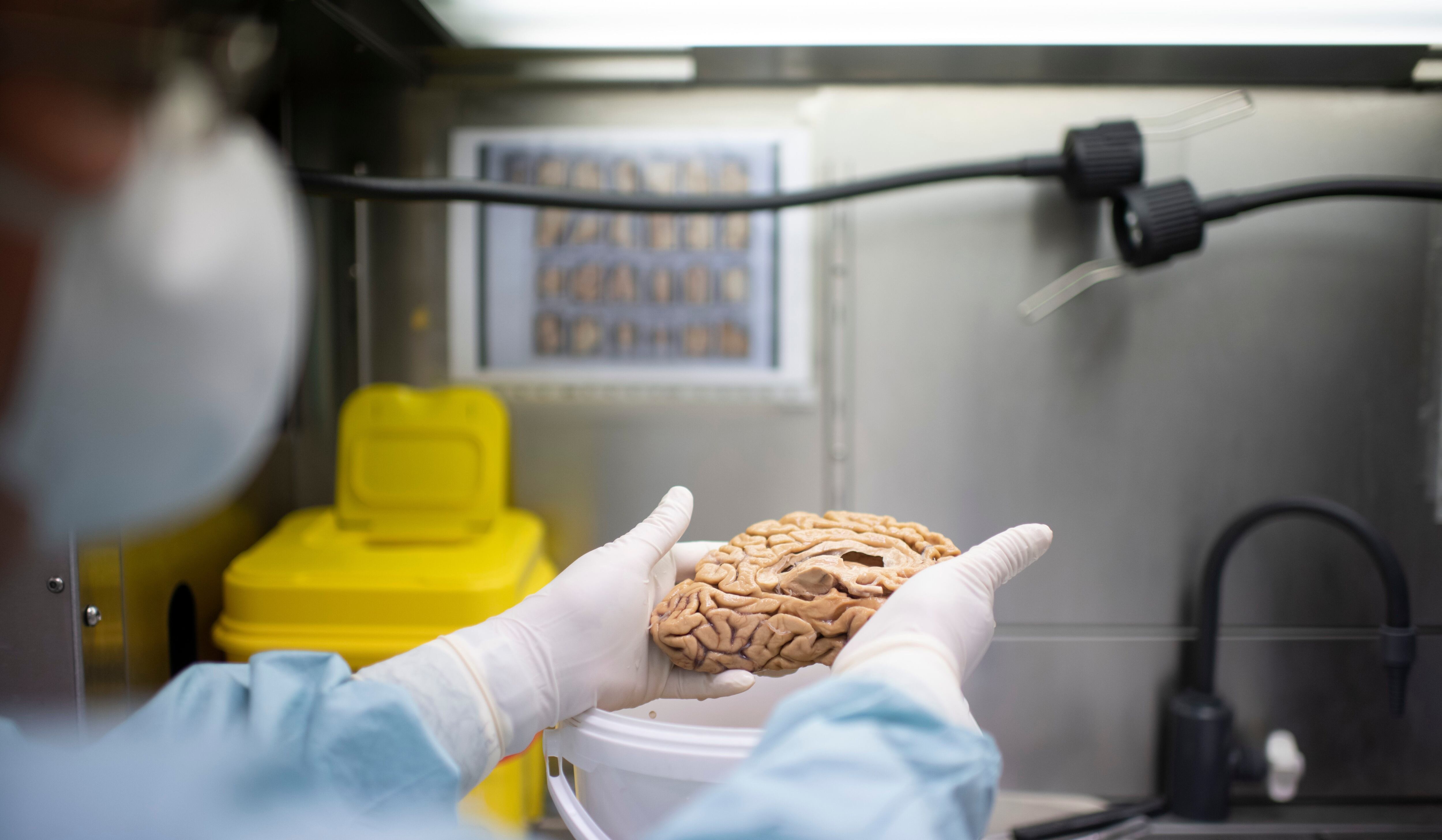 Un investigador maneja un cerebro en la Fundación Cien, en Madrid.