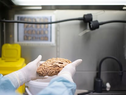 A researcher handles a brain sample.