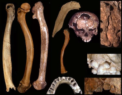 Huesos y dientes con anomalías de distintos yacimientos.