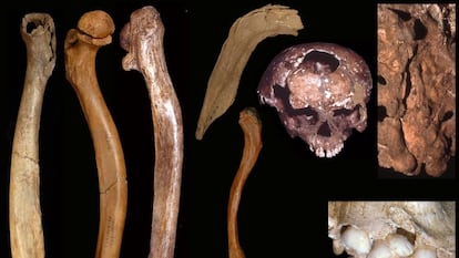 Huesos y dientes con anomalías de distintos yacimientos.