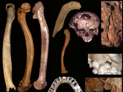 Huesos y dientes con anomalías de distintos yacimientos.