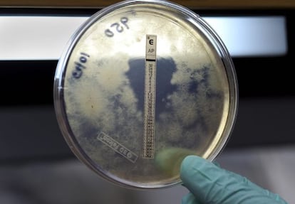 Imagen cedida por el Centro de Control y Prevención de Enfermedades de un trabajador analizando una muestra de un hongo de meningitis en Atlanta.