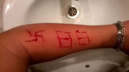 Imagen del brazo con la esvástica y el número 88 nazi en una imagen de Twitter.