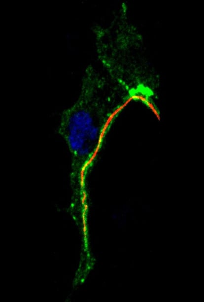 Grabación con microscopía confocal del desarrollo de un embrión de la mosca del vinagre. La inclusión de una proteína fluorescente desvela cómo se forman las ramificaciones del sistema respiratorio.