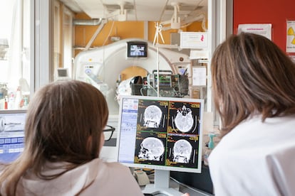 El diagnóstico de lesiones cerebrales es uno de los usos habituales de la resonancia magnética,