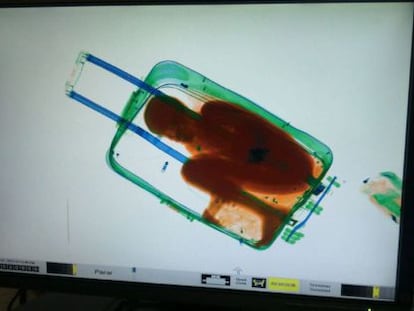 A security scanner image of eight-year-old Abou inside the suitcase.