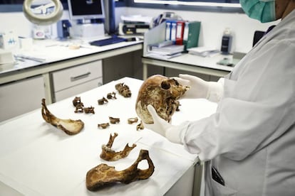 Una trabajadora del Instituto Nacional de Toxicología analiza unos restos humanos.
