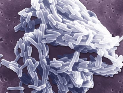 La bacteria 'Listeria monocytogenes'.