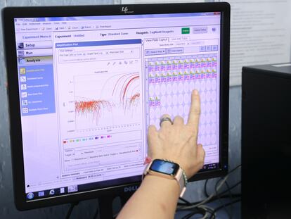 Un científico del Centro Nacional de Microbiología, en España, muestra la secuencia completa del virus de la viruela mono, el jueves 26 de mayo de 2020.