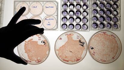 Placas de Petri con cultivos de células en el Centro de Biología Molecular "Severo Ochoa", instituto perteneciente a la Agencia Estatal Consejo Superior de Investigaciones Científicas (CSIC).
