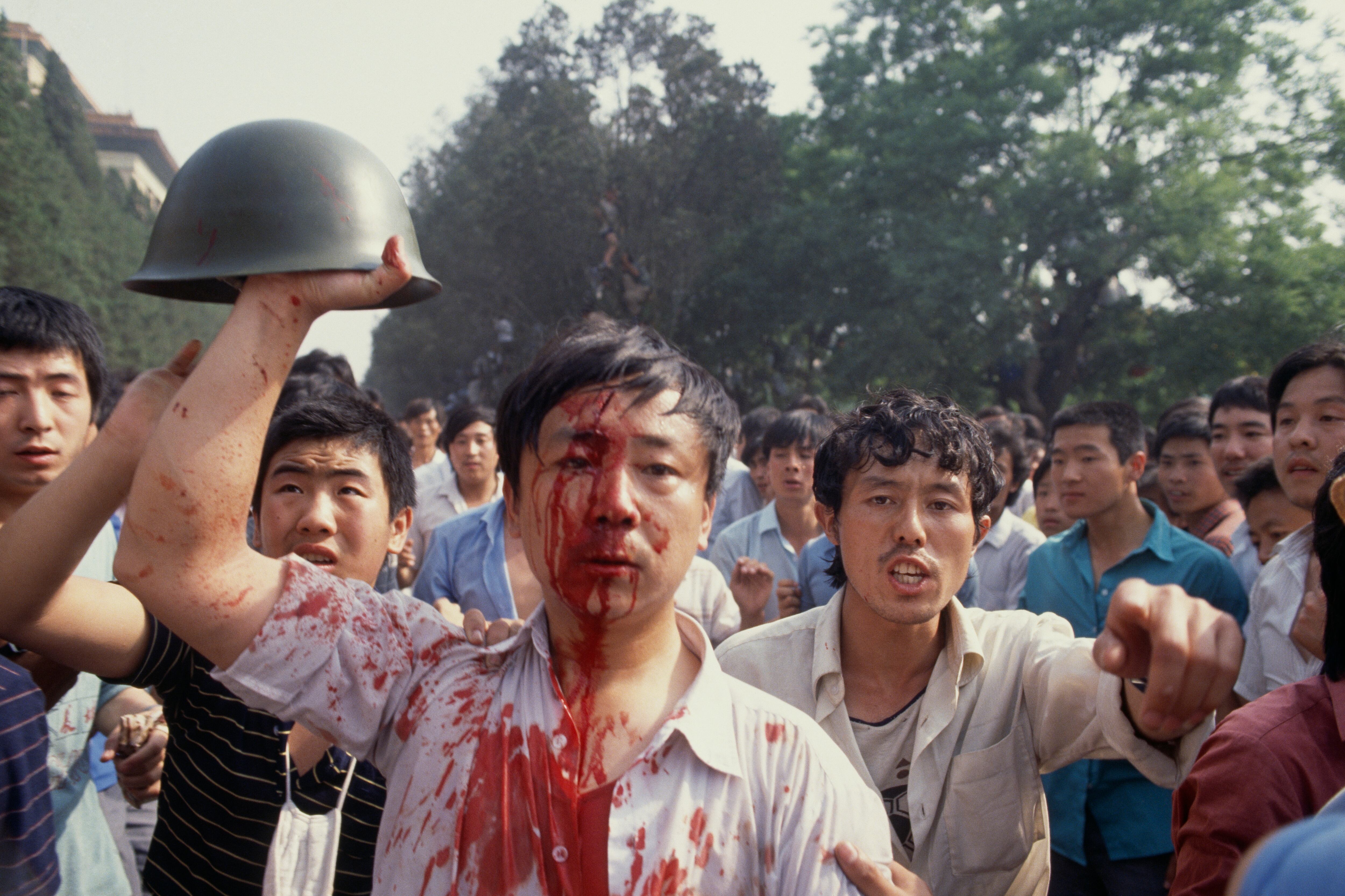 Un hombre es herido tras el enfrentamiento entre el Ejército chino y los manifestantes.