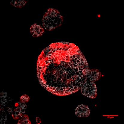 Organoide de cáncer colorrectal con células malignas responsables de metástasis marcadas en rojo. Descubrirlas ha sido un importante avance de este año