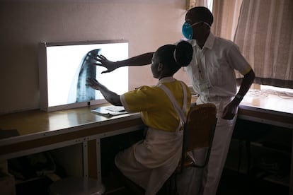 Os gestores de saúde exigem melhorias tanto na formação, para ter mais profissionais, quanto nos equipamentos que esses especialistas podem utilizar para melhorar a saúde dos pacientes. Na imagem, dois médicos reveem uma radiografia no Hospital Central da Beira. A área de radiologia foi recentemente reabilitada, após ter sido afetada pelo Ciclone Idai, em março de 2019.