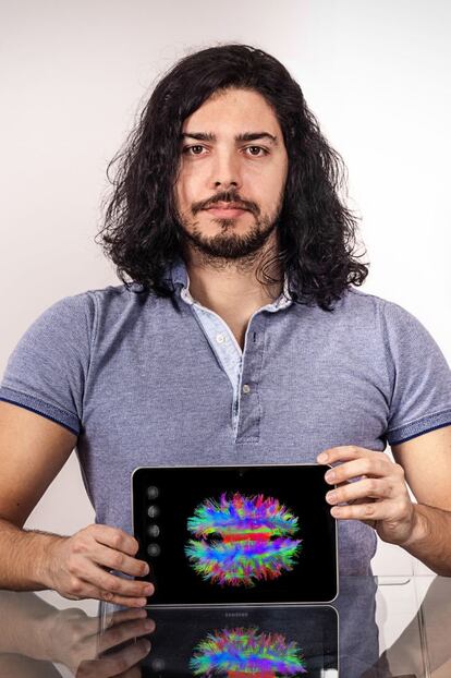 Paulo Rodrigues de Mint Labs que compite en code_n con CloudN, una plataforma de visualización tridimensional de imágenes del cerebro procedentes de resonancias.