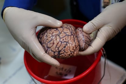 File image of a human brain bank in New York.