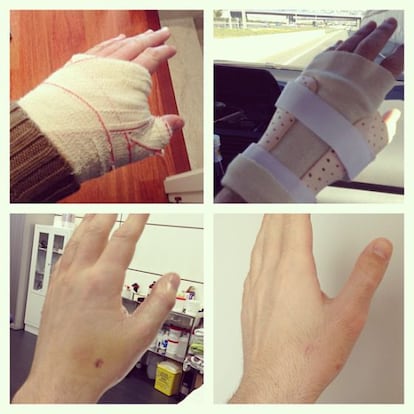 Montaje de la recuperación de la mano de Casillas.