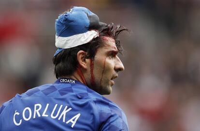 Maquillaje también habría necesitado  Vedran Corluka que se abrió una brecha en la cabeza durante el Croacia-Turquía. 