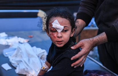 Una niña herida, tras un ataque israelí, es tratada en el hospital Kuwait, este miércoles en Rafah.