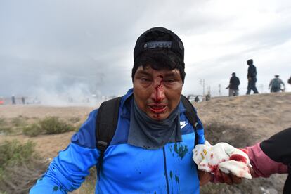 Un hombre herido en los enfrentamientos con la policía, en Arequipa el jueves.