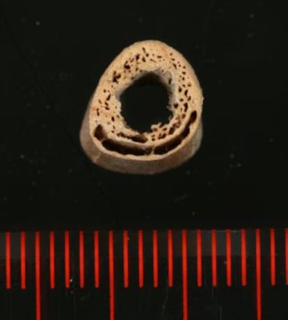 Secci&oacute;n de un h&uacute;mero del humano de Siberia de hace 24.000 a&ntilde;os denominado MA-1.
 
 