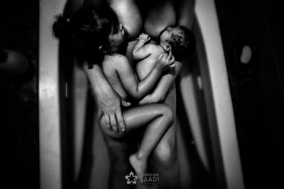 Esta imagen es la ganadora como Mejor Foto de Posparto: Blanco y Negro y su autora es Karoline Saadi (Brasil). Denominada 'Hola, mi hermanita' y su descripción es: "Al conocer a su hermana recién nacida, las dos niñas son amamantadas por la madre". 