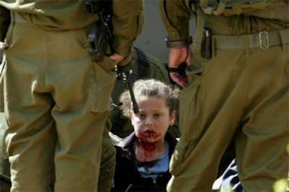 La niña palestina Nesreen Hash, de 8 años, herida por una pelota de goma durante una operación militar israelí en Hebrón (Cisjordania).