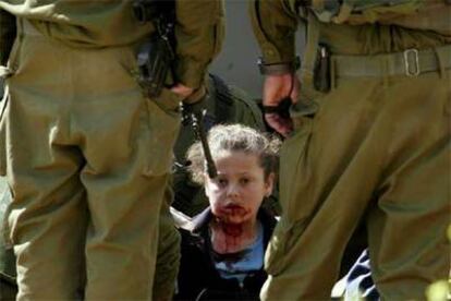 La niña palestina Nesreen Hash, de 8 años, herida por una pelota de goma durante una operación militar israelí en Hebrón (Cisjordania).