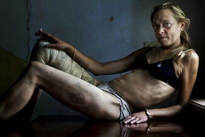 Imagen tomada por Brent Stirton, de la agencia Getty. Muestra a una prostituta y drogadicta de Ucrania.