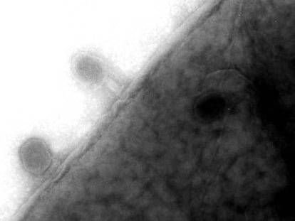 Virus fagos en la membrana de una bacteria &#039;E. coli&#039;.