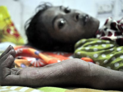 Una mujer enferma de tuberculosis, en el hospital de Agartala, en el distrito de Tripura, India.