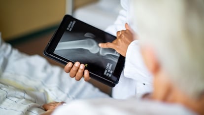 Cropped shot of a female doctor showing result of radiography on digital tablet to patient and giving diagnosis