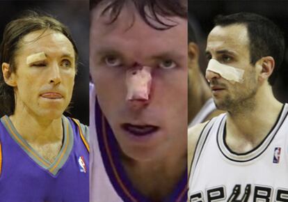 Nash y Ginobili sufren las heridas de guerra de la NBA.