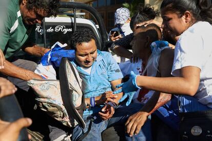 Un herido durante la represión en Nicaragua.