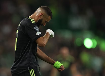 Karim Benzema se retira este martes del Celtic Park tras sentir molestias.
