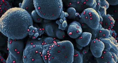 El nuevo coronavirus SARS-CoV-2 al microscopio.