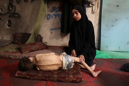 Samah Matar se sienta junto a su hijo desnutrido en una escuela donde se refugian.