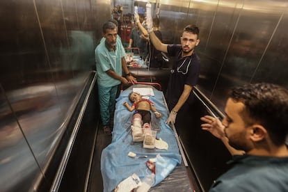 Palestinian doctors treat an injured child at Khan Younis hospital after an Israeli airstrike on Monday.