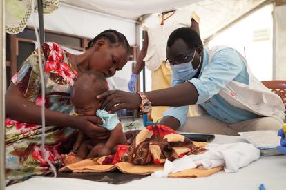 El doctor Francis Ajarial examina a una niña de dos meses en la sala de pediatría del hospital de MSF en Malakal. 