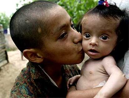 Franco Dibenedetti besa a su hermana de seis meses, que sufre malnutrición, en Tucumán.