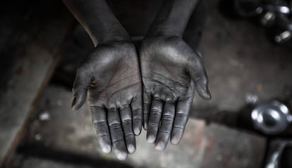 Restos de aluminio en las manos de un niño que trabaja en una fábrica en Dacca (Bangladés).